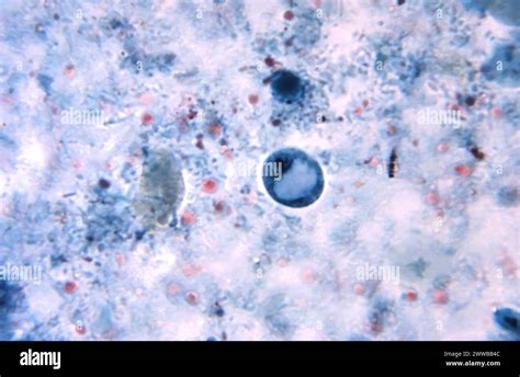  Iodamoeba: Eine faszinierende mikroskopische Welt voller bewegungsgestützter Schleim-Entdeckungen!