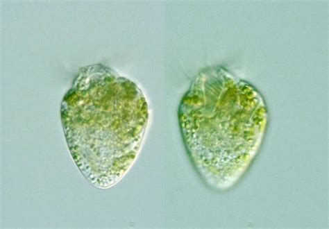  Strombidium: Ein winziges Wesen mit Tentakeln für ein episches Mikrokosmos-Festmahl!